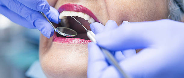 Best Broken or Chipped Tooth Repair in Pine Ridge, FL